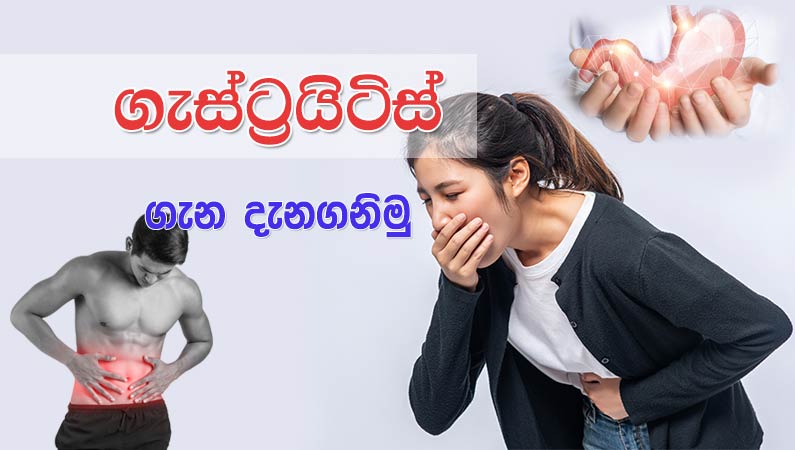 ගැස්ට්රයිටිස් ගැන දැන ගනිමු.